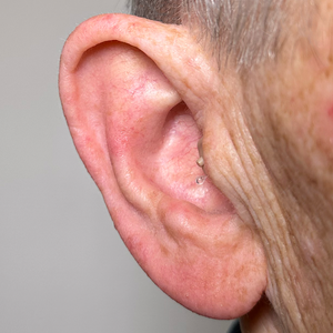 Micro CIC Digital Rechargeable Hearing Aids (Pair Of 2)
